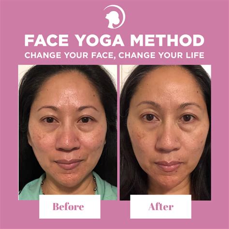 angion method|angion method before and after.